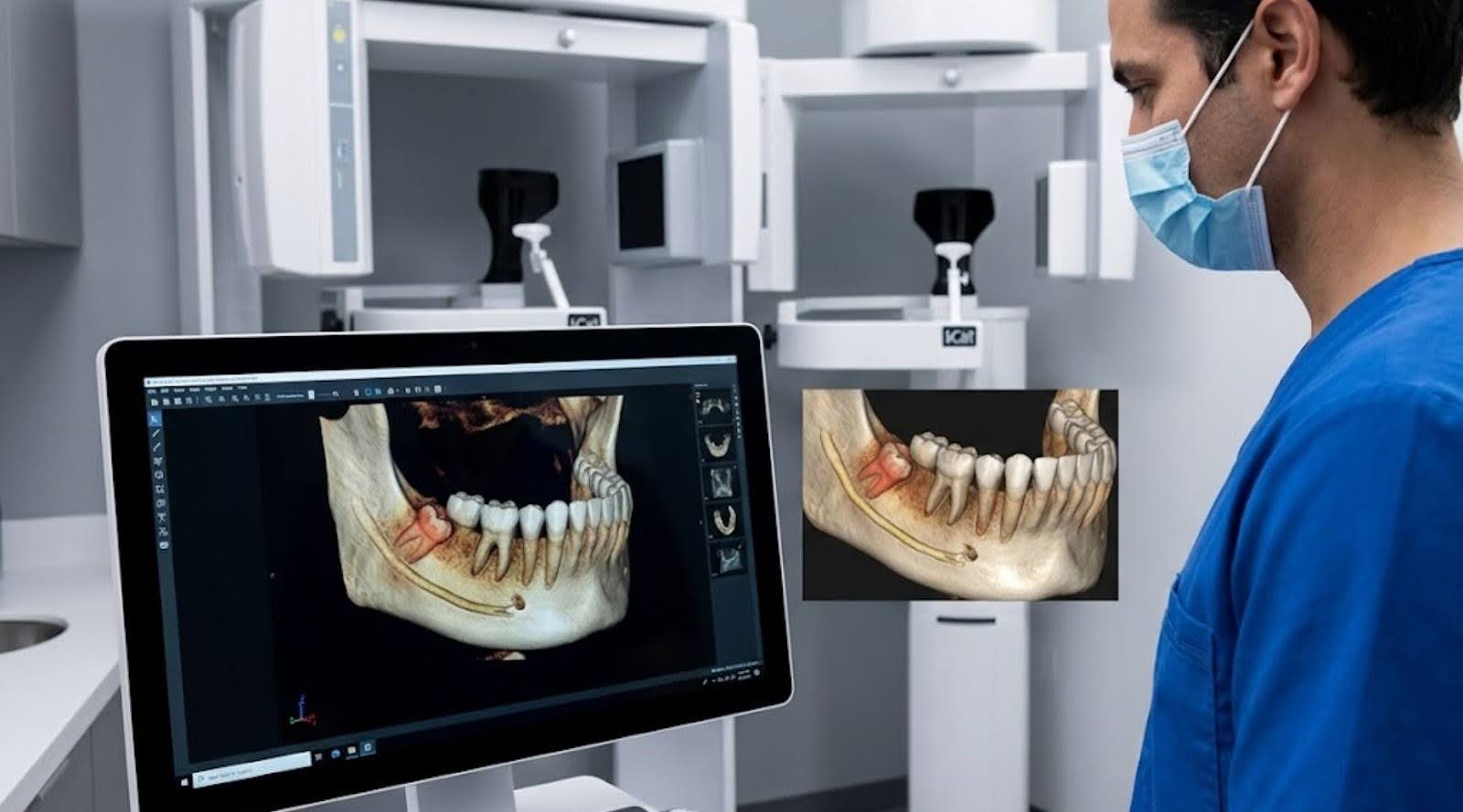 How iCat 3D Imaging Makes Wisdom Teeth Extractions Safer in Sioux Falls iCat 3D imaging wisdom teeth extraction