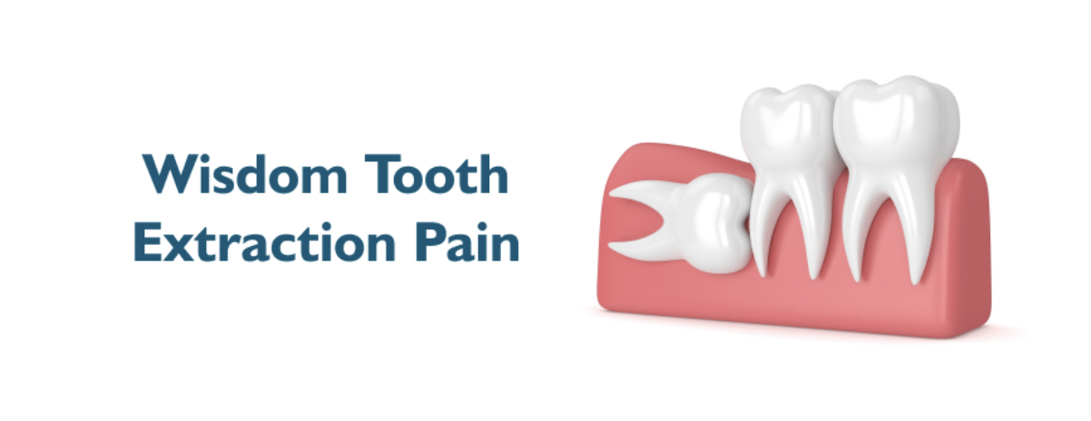 wisdom tooth extraction pain Wisdom tooth extraction pain illustration